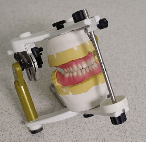 i-denture-3