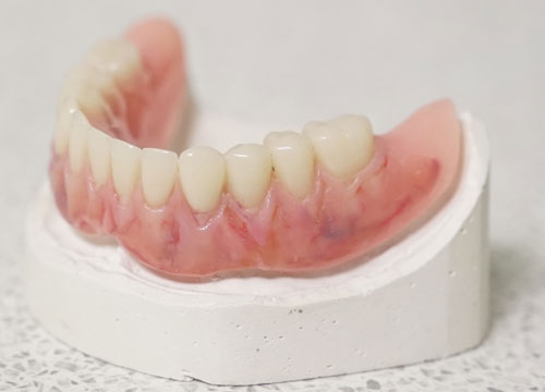 i-denture-5