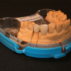standardcrown2 (1)