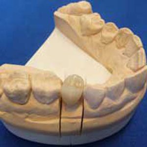 teeth1
